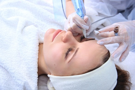 One IPL Photofacial (Lumenis Stellar M-22 Laser) - Inner Glow Lab LLC