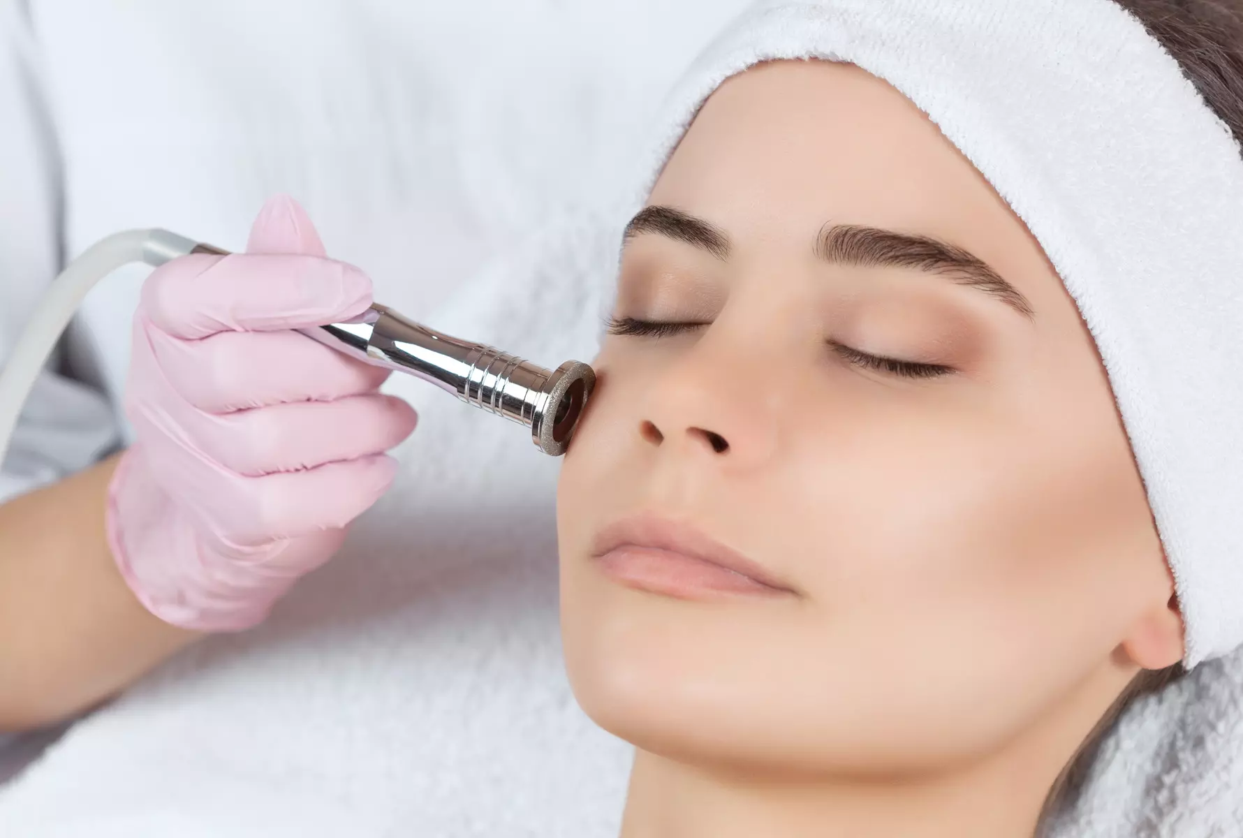 Skin Peel treatment at Miami Kiss