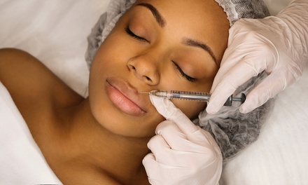 One Syringe of Restylane L or Lyft - Synerchi Medical Spa