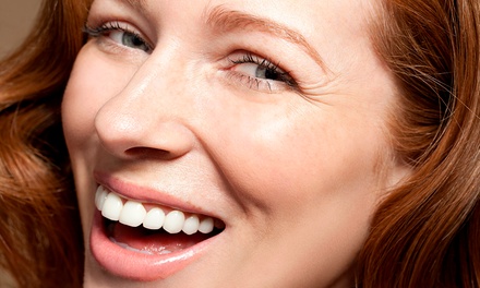 1x 40 Min. Kosmetisches Zahn-Bleaching für 1 Person - Beauty Salon Neuss