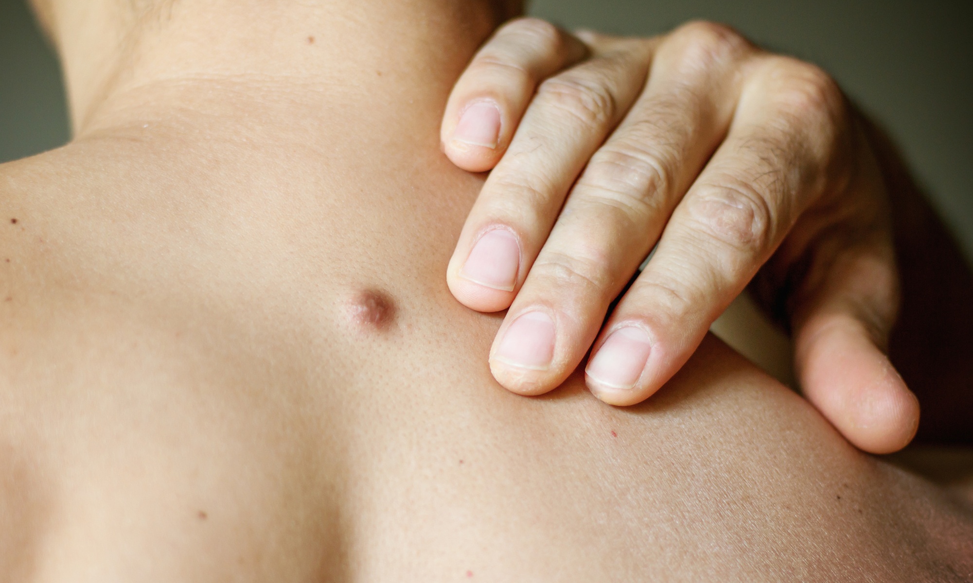 Remove Skin Tags Effectively with Non-Invasive Technology