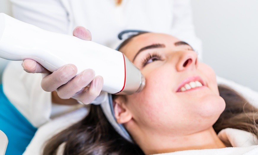 Image 1: Skin Needling Treatment with Optional Light Therapy 