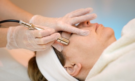 One 40-Mnute Diamond Microdermabrasion Treatment with 5-Minute Golden or Vitamin C Mask - Vitality Works Medical Spa