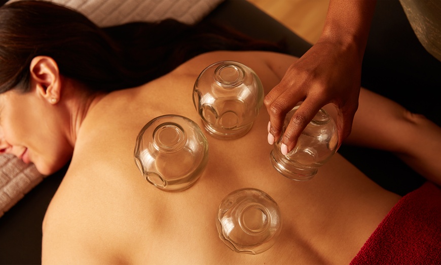 Image 1: 30-minute or 1-hour Cupping Session with Optional Massage