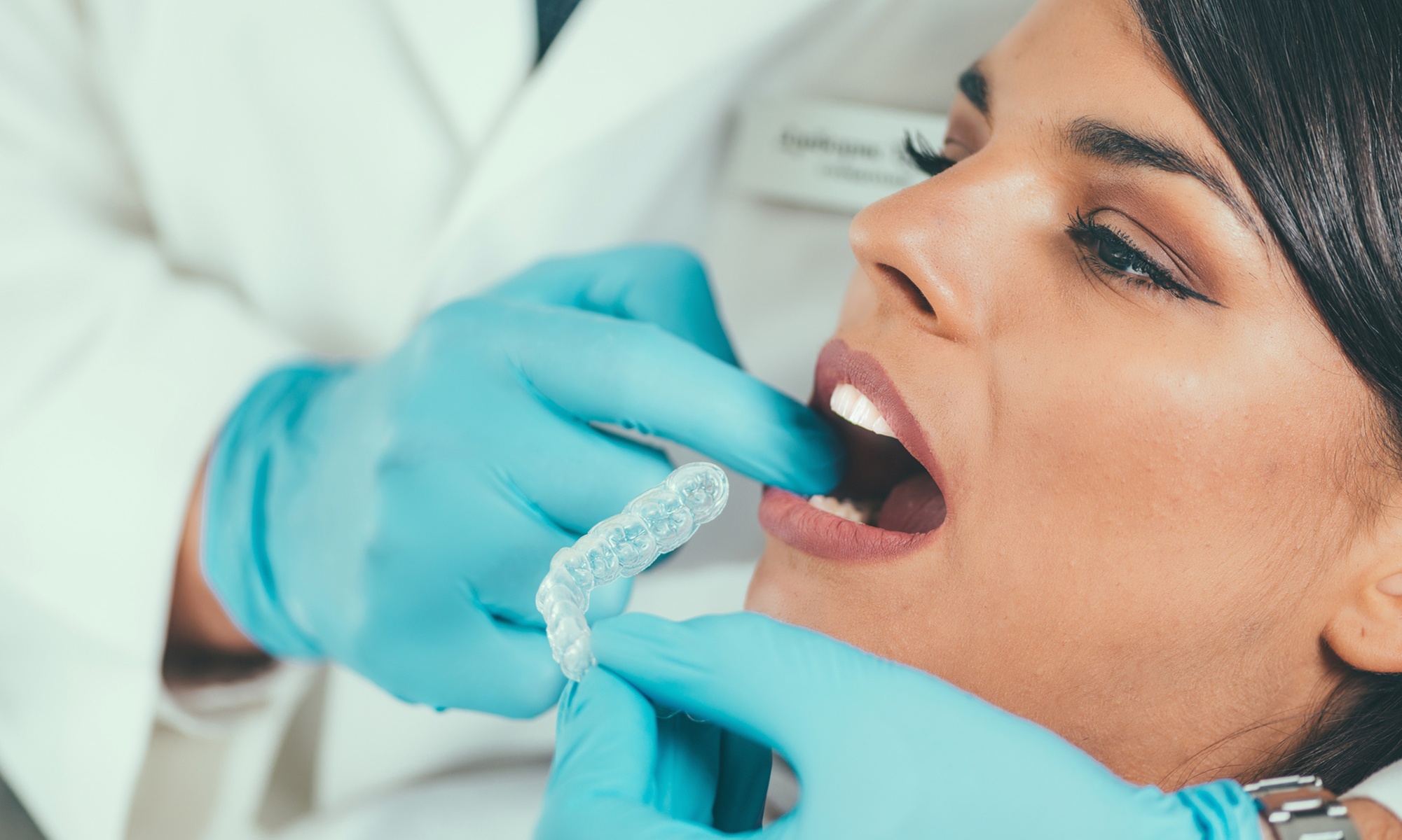 1 o 2 retenedores de ortodoncia transparentes con limpieza bucal