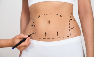 Explore Non-Invasive Laser-Lipo Sculpting Treatments Explore Non-Invasive Laser-Lipo Sculpting Treatments