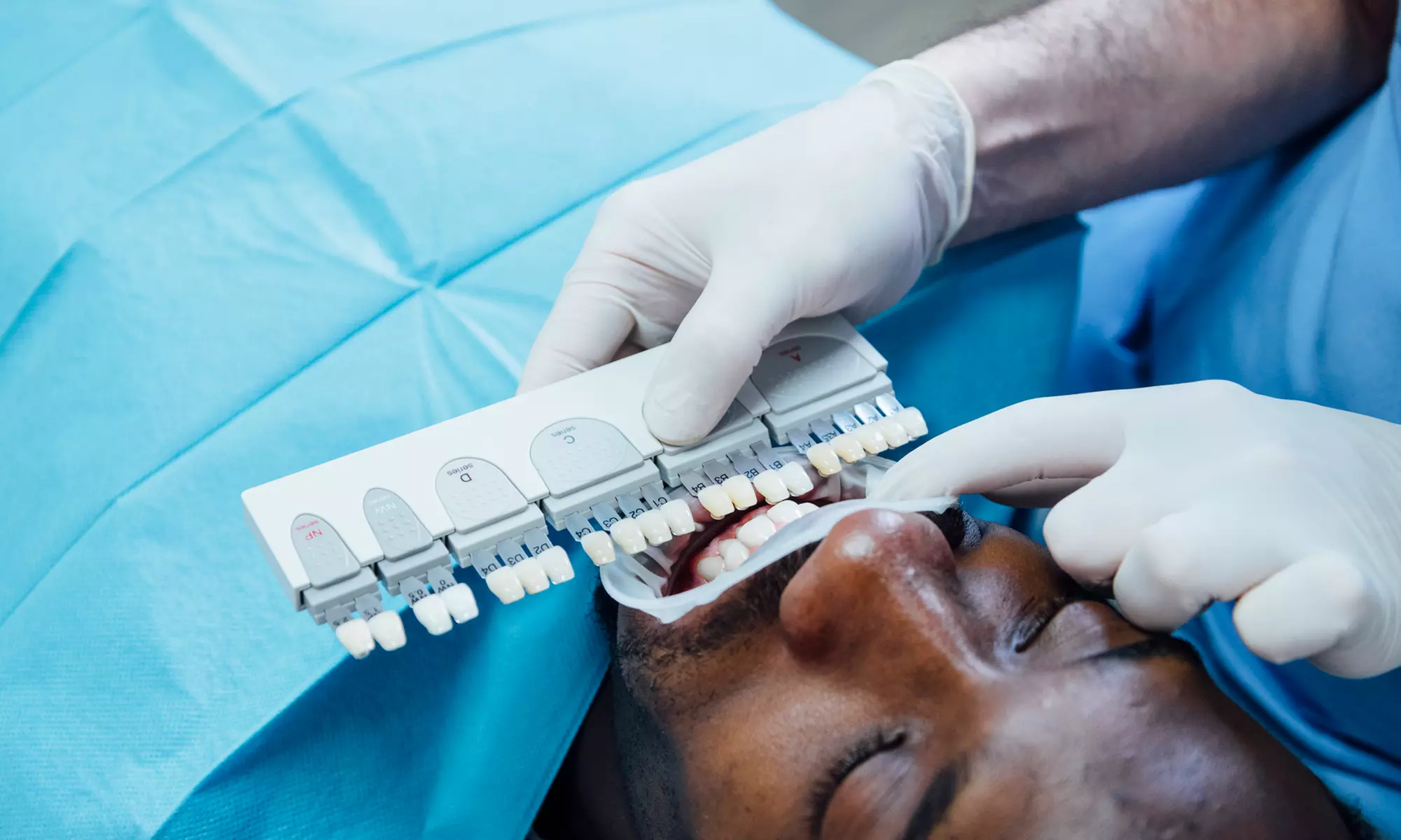 One or Two Teeth Whitening Treatments