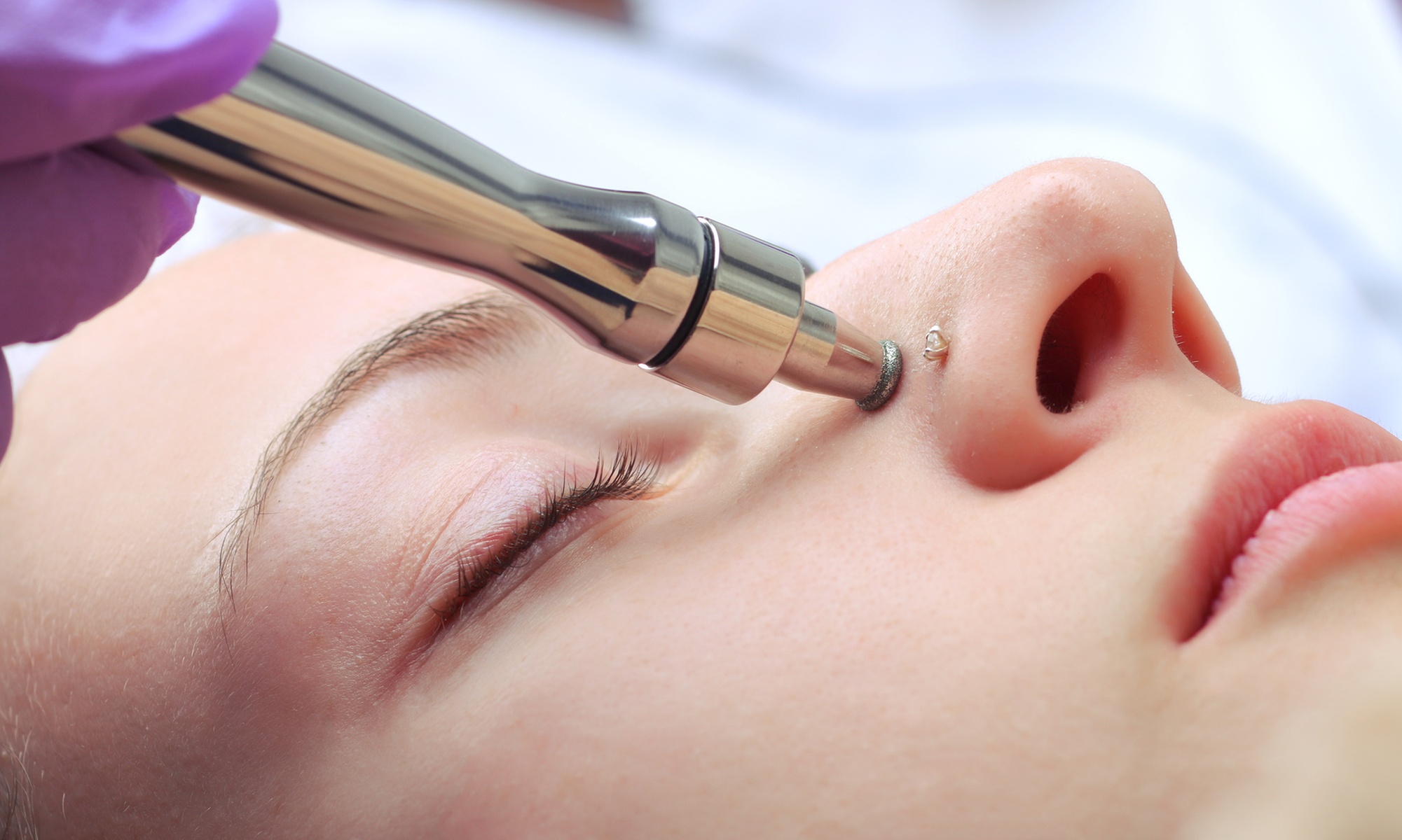 One or Three Microdermabrasion Sessions at Skin By Leslie (Up to 40% Off). Three Options Available.