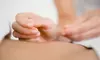 Up to 50% Off on Acupuncture with a 12-Month Membership or 11 Sessions at Chi Happens Acupuncture