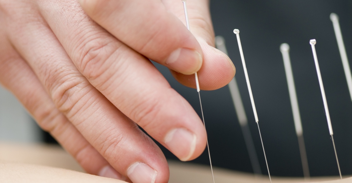 Sesiones de acupuntura para una persona en Madrid