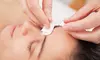 Revitalize Your Body with One Acupuncture Session at Metabolic Weight Loss Centers (Up to 55%Off)