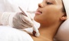 Rejuvenate with One, Two, or Three LED Microneedling Facials at Serenity Skin Care Studio Inc. (Up to 45% Off)
