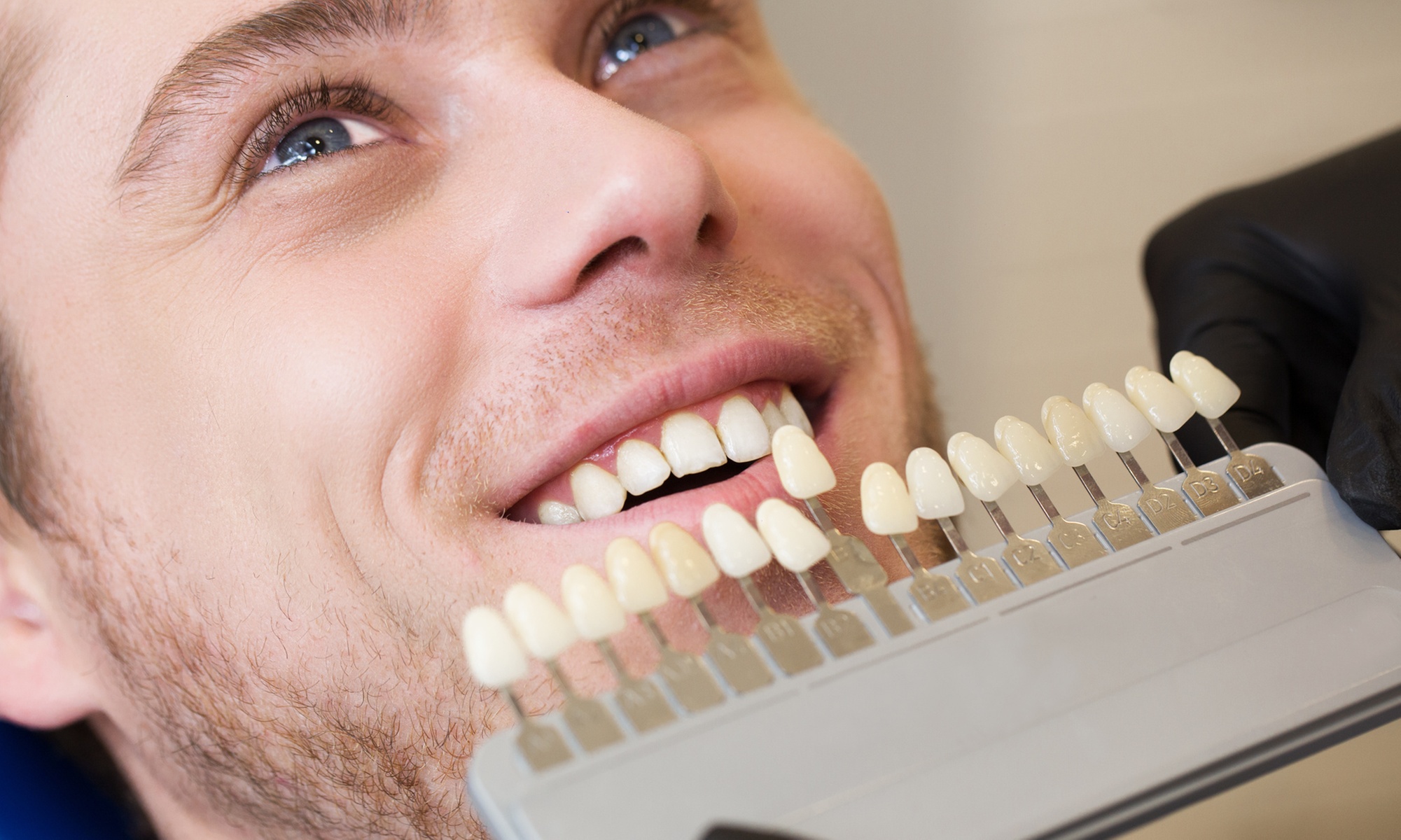 Szybkie wybielanie zębów lampą LED dla pięknego uśmiechu