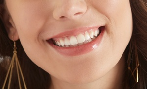 Teeth Whitening at I-Smile Teeth Whitening