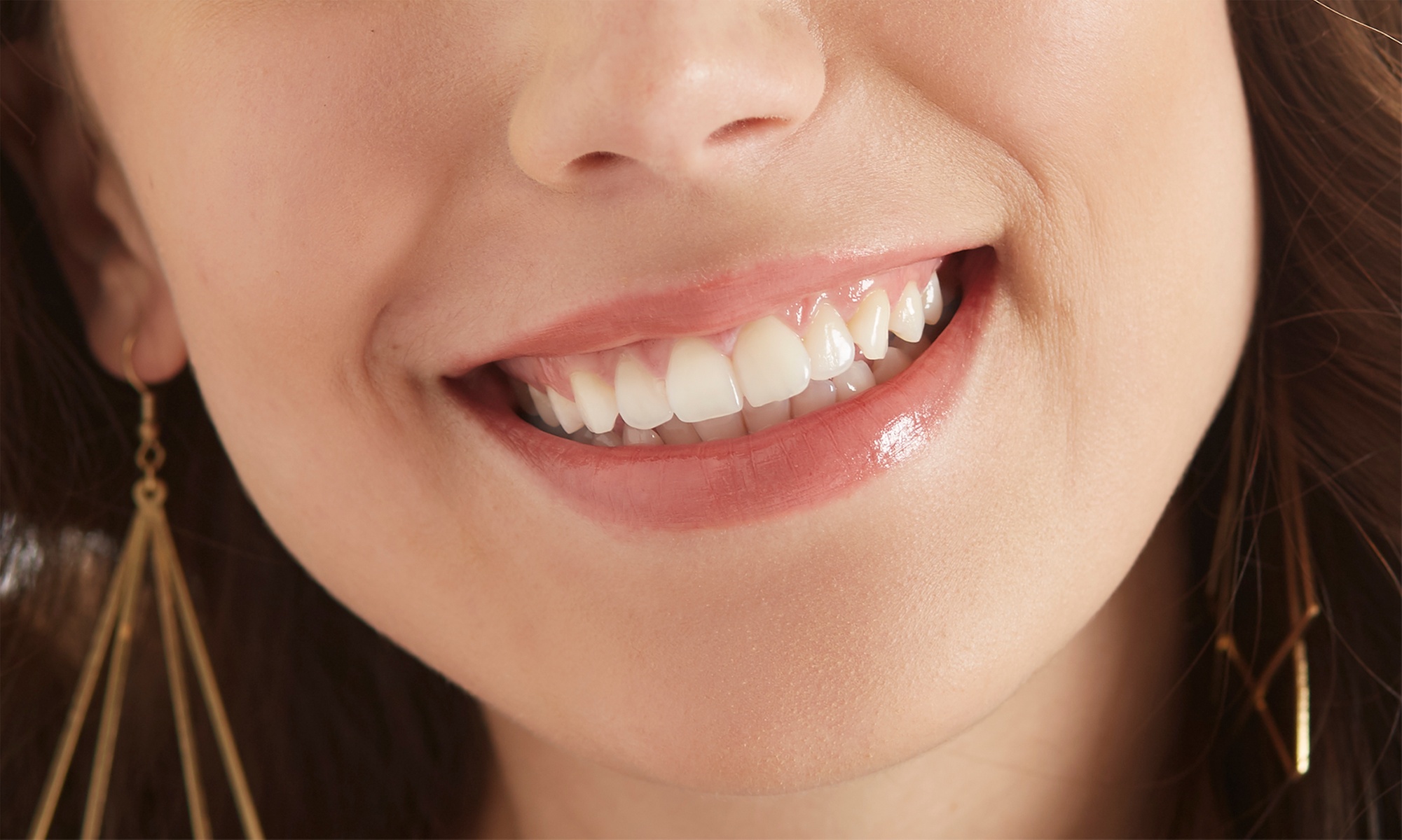 60% Off Teeth Whitening Treatment at Doll Face Spa
