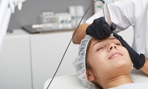 Sesión de microblading o microshading de cejas en Surur Belleza Sesión de microblading o microshading de cejas en Surur Belleza