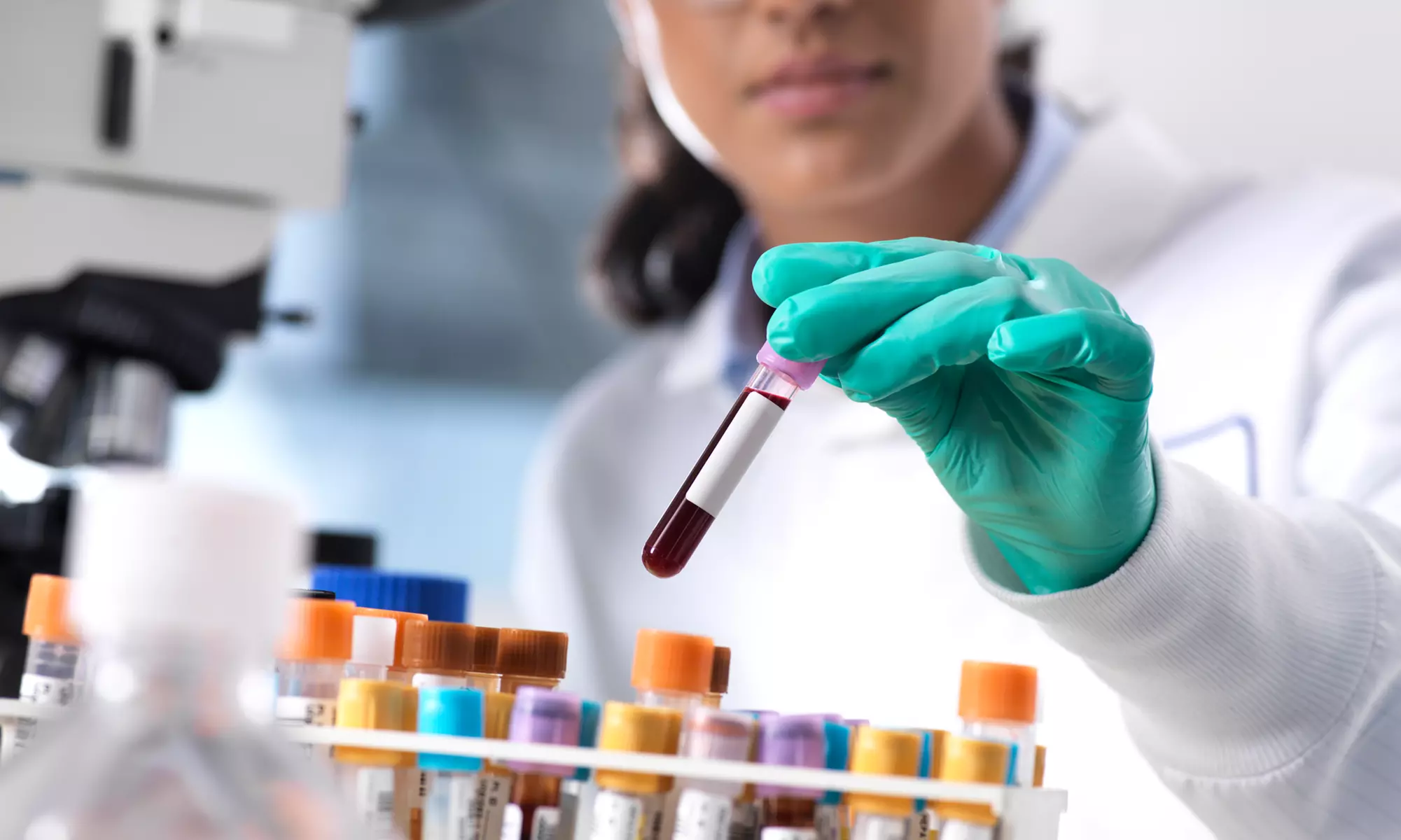 Do 61% zniżki na Badania krwi w Club Zdrowia - Primary Image