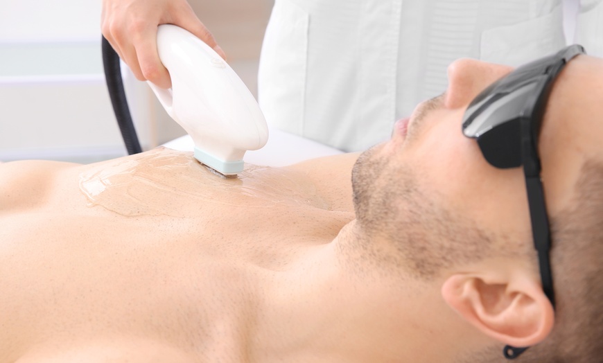 Image 1: Up to 70% Off on Laser Hair Removal - Men at King Street Grooming