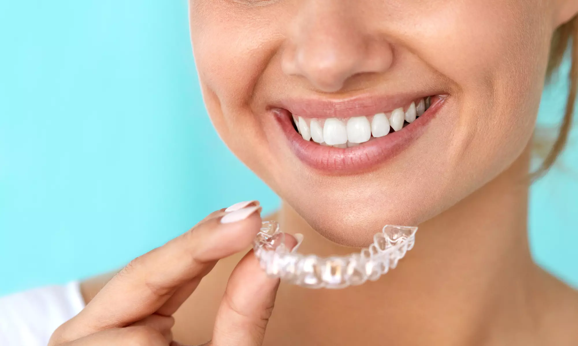 Trinity Spa offers 1 teeth whitening service for a brighter smile, up to 35% off - Primary Image