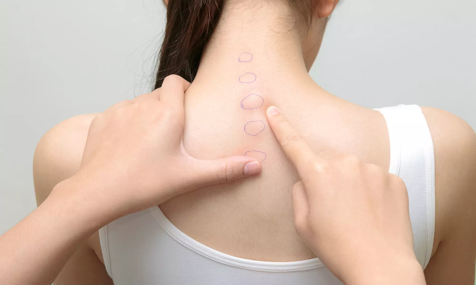 Get Chiropractic Consultation, Exam, & a Therapy w/ an Optional Adjustment (Up to 59% Off) - Primary Image