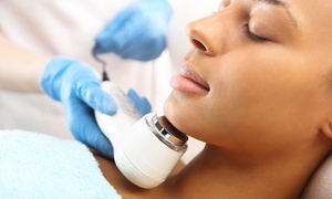 Microdermabrasion + LED Treatment