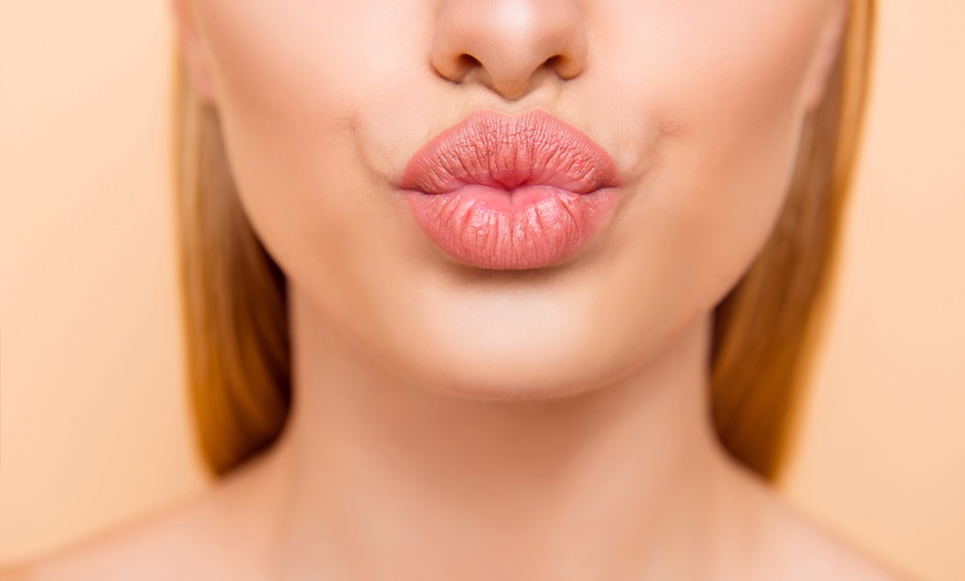 Image 1: 1ml or 2ml Dermal Filler With Consultation 