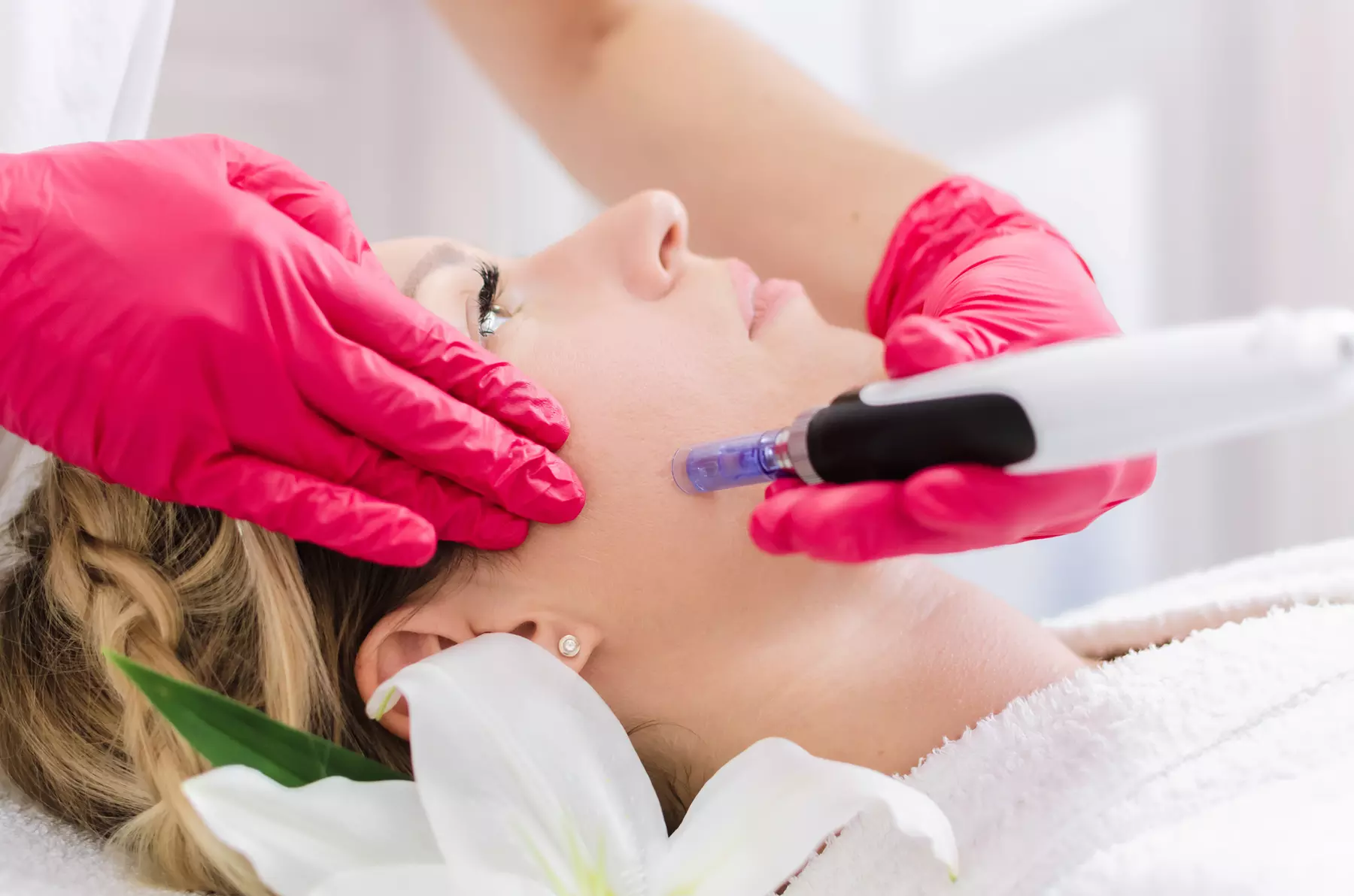 IPL, Exosomen, Microneedling & klassische Pflege – Hautpflege für dich