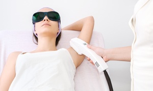 Ultrasonic Arm Fat Reduction: 2, 4 or 6 Treatment Sessions