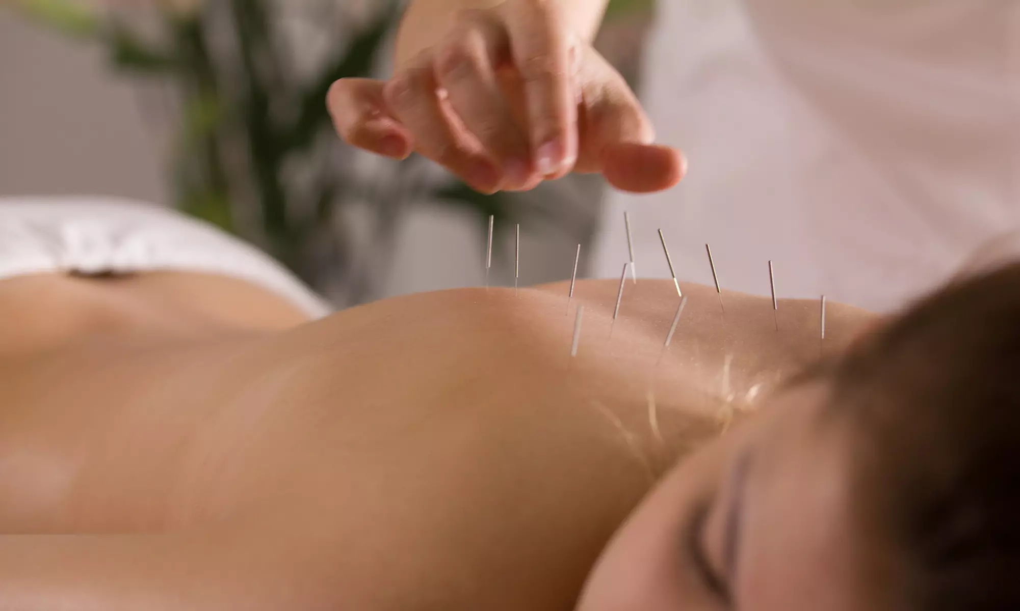 Discover Relaxation: Therapeutic Massage with Optional Acupuncture Treatment: 30-Minute Session (Up to 73% Off) - Primary Image