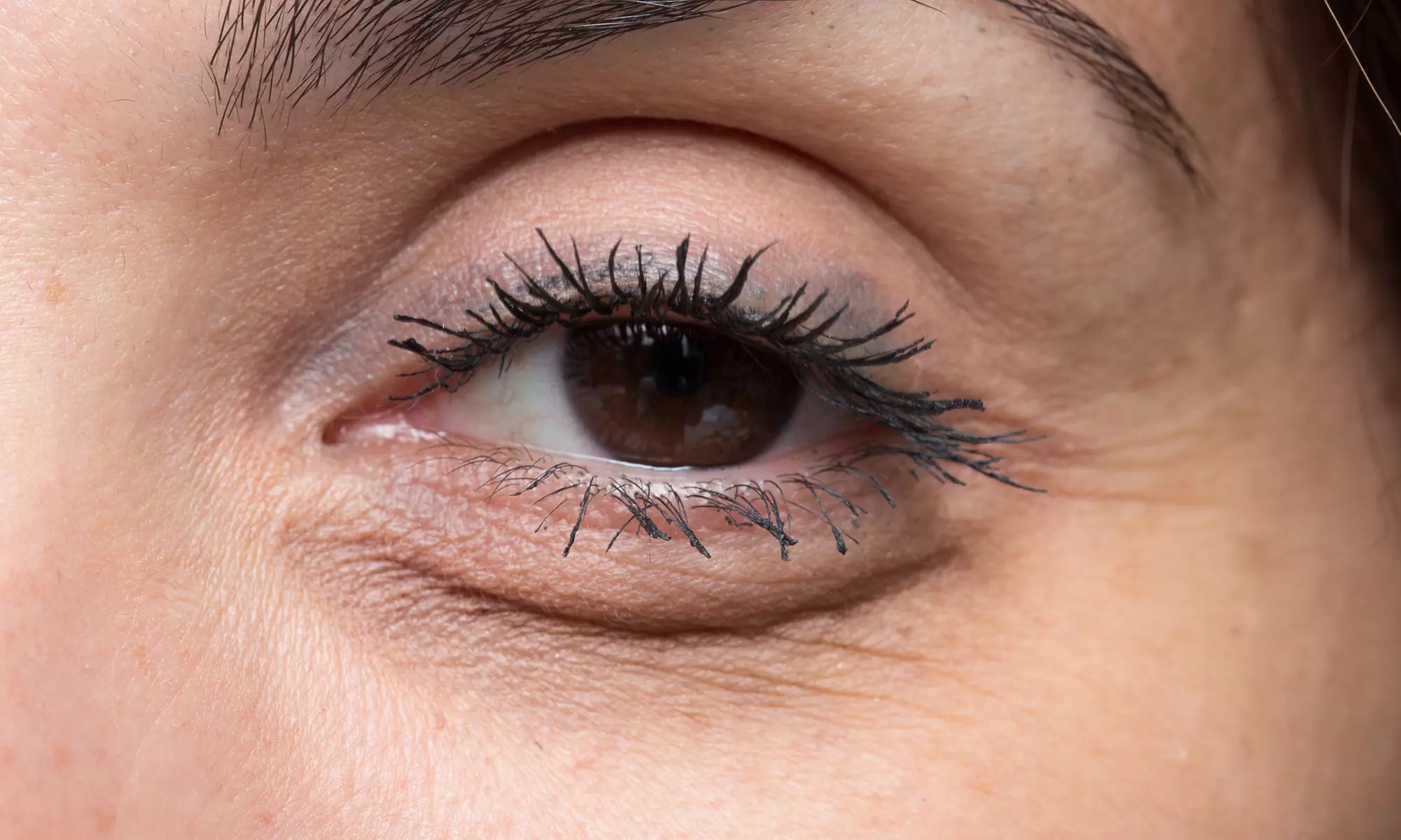 Two, Three, or Four IPL (intense pulsed light)Treatments for Dry Eyes at BattuVision (Up to 30% Off) - Primary Image
