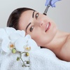 Image 1: 1 or 3 Sessions of Microdermabrasion for Face, Neck or Body w/ Facial 