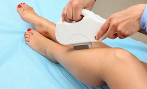 Achieve Smooth Skin with Laser Hair Removal Sessions on Choice of Area