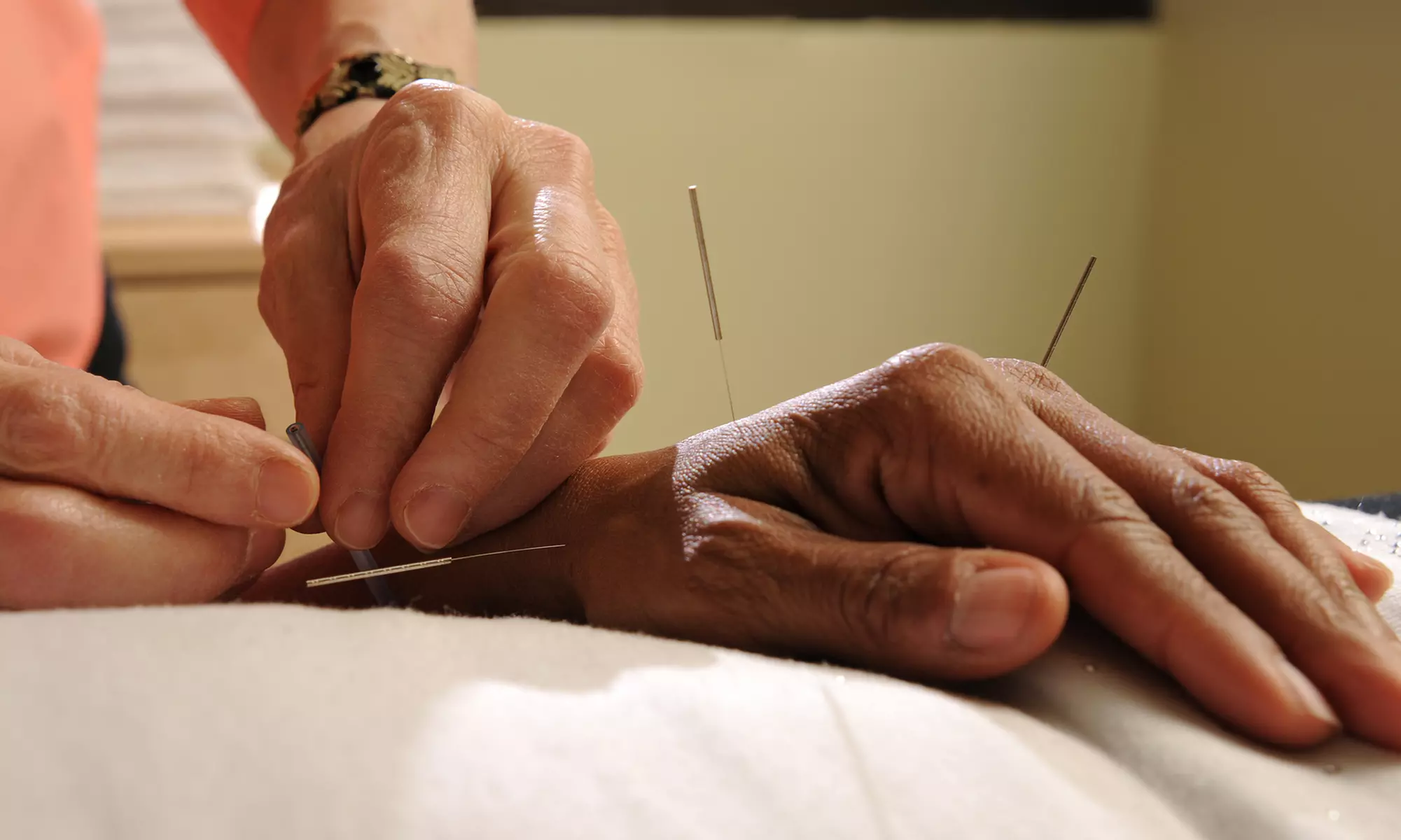 Dive into Relaxation at The Acupuncture Lounge: Enjoy 41% Off on NEW Initial Treatment or Three Treatment Package! - Primary Image