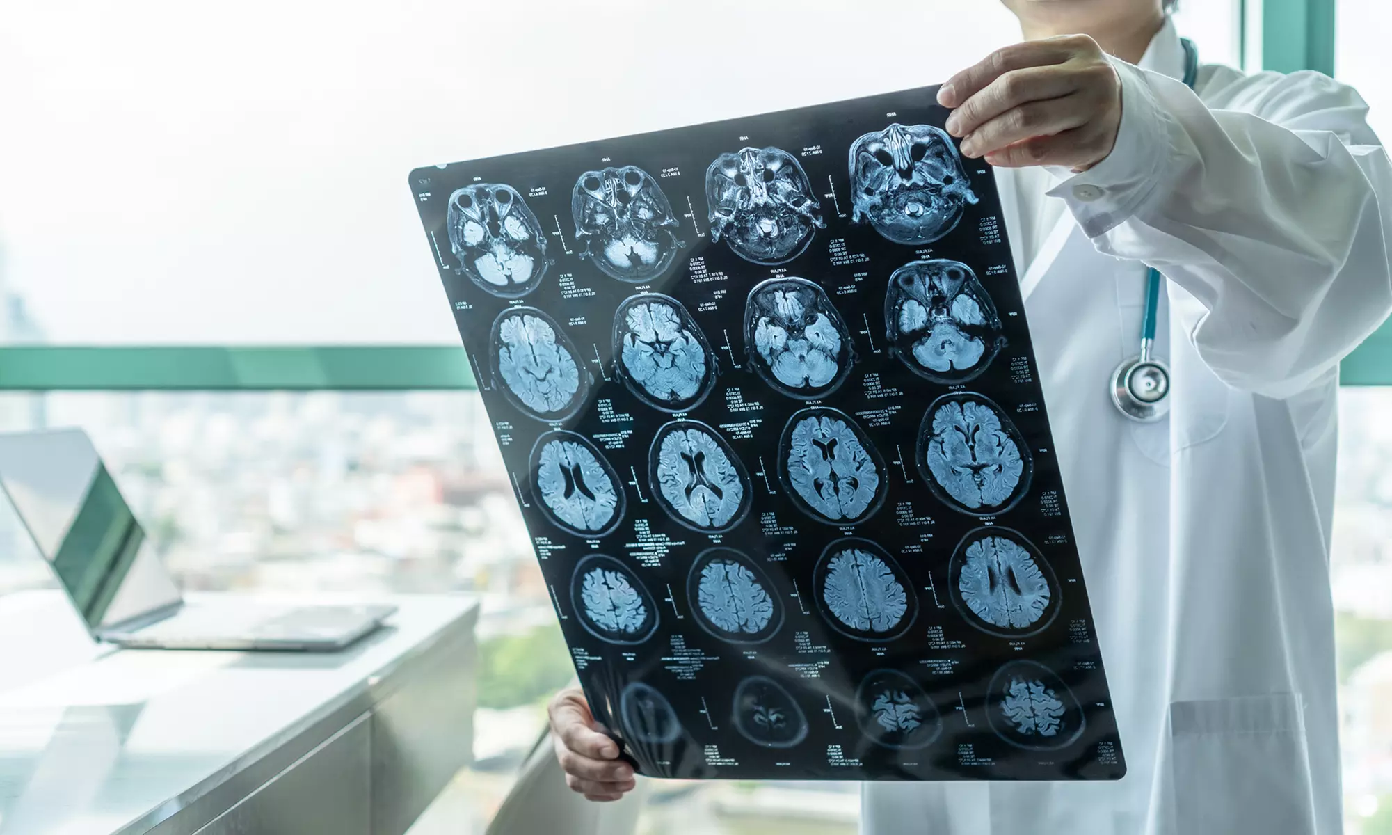 Discover USA Longevity Center's CT Scans: Heart, Lung, and Full Body Options with up to 25% off - Primary Image