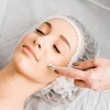 Image 1: Up to 52% Off on Micro-Needling at JM Aesthetic clinic