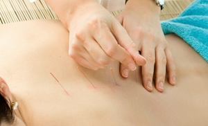 Acupunctuur en shiatsu olie massage