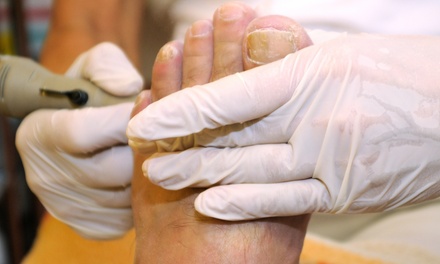 Bay Area Foot Care - Up To 70% Off | Groupon