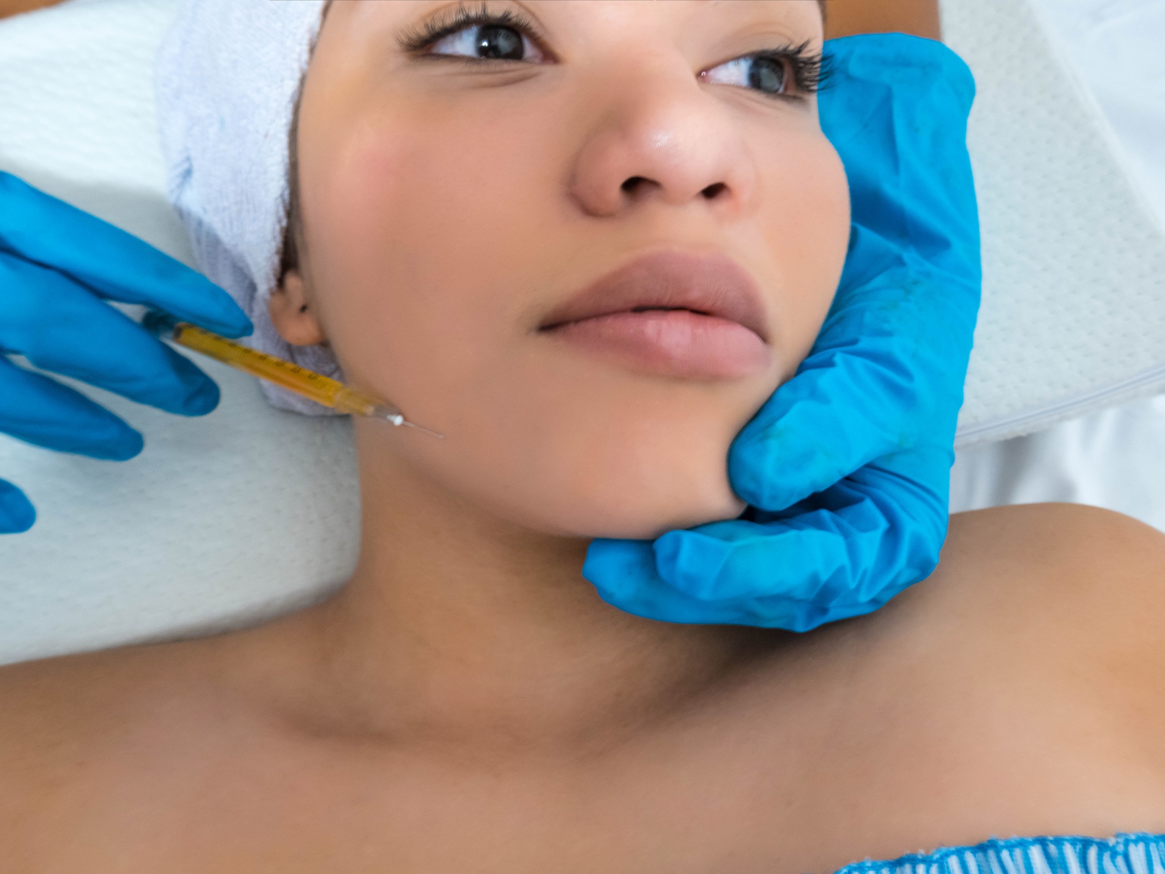 IPL Photofacial w/ Optional Jeuveau or Dermal Filler at up to 46% Off
