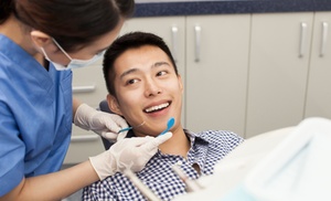 Implantes dentales y limpieza Implantes dentales y limpieza