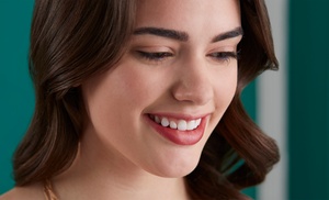 Limpieza dental y 1 o 2 blanqueamientos en Sol Dental Limpieza dental y 1 o 2 blanqueamientos en Sol Dental