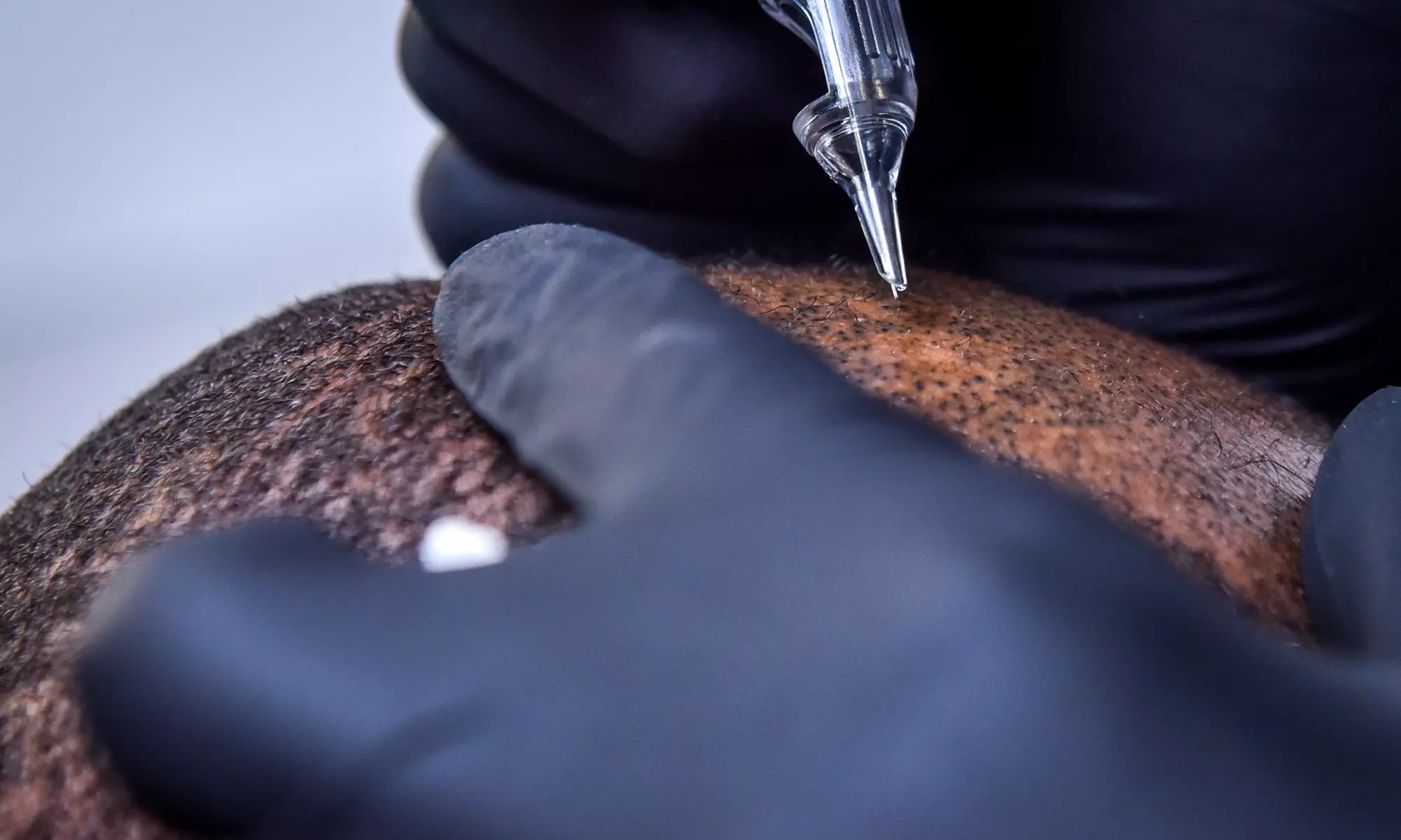 Scalp Micropigmentation at Mystic Browz - Primary Image