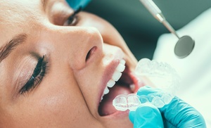Férula de descarga con guías caninas en Pal Dental Bravo Murillo Férula de descarga con guías caninas en Pal Dental Bravo Murillo