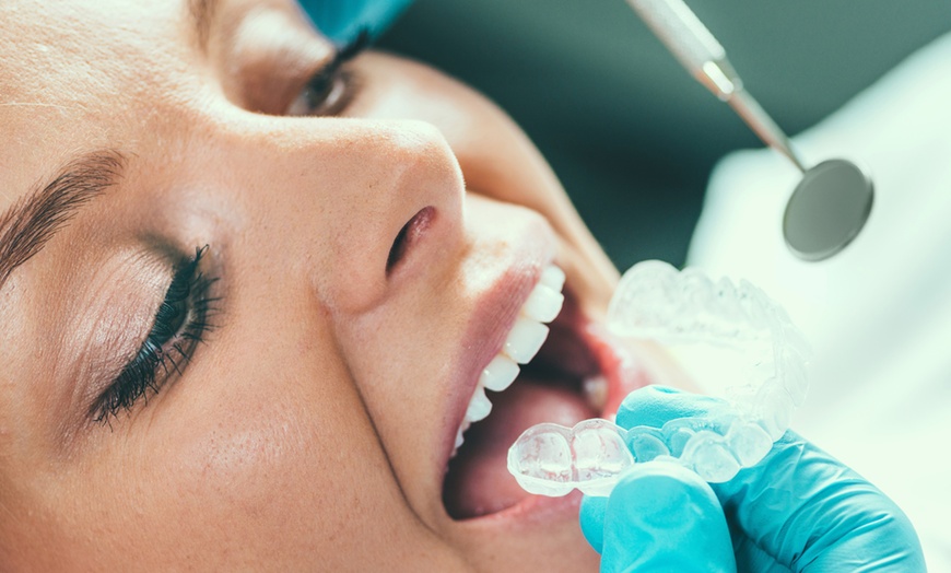 Image 1: Dientes alineados por más tiempo: retenedor transparente con limpieza