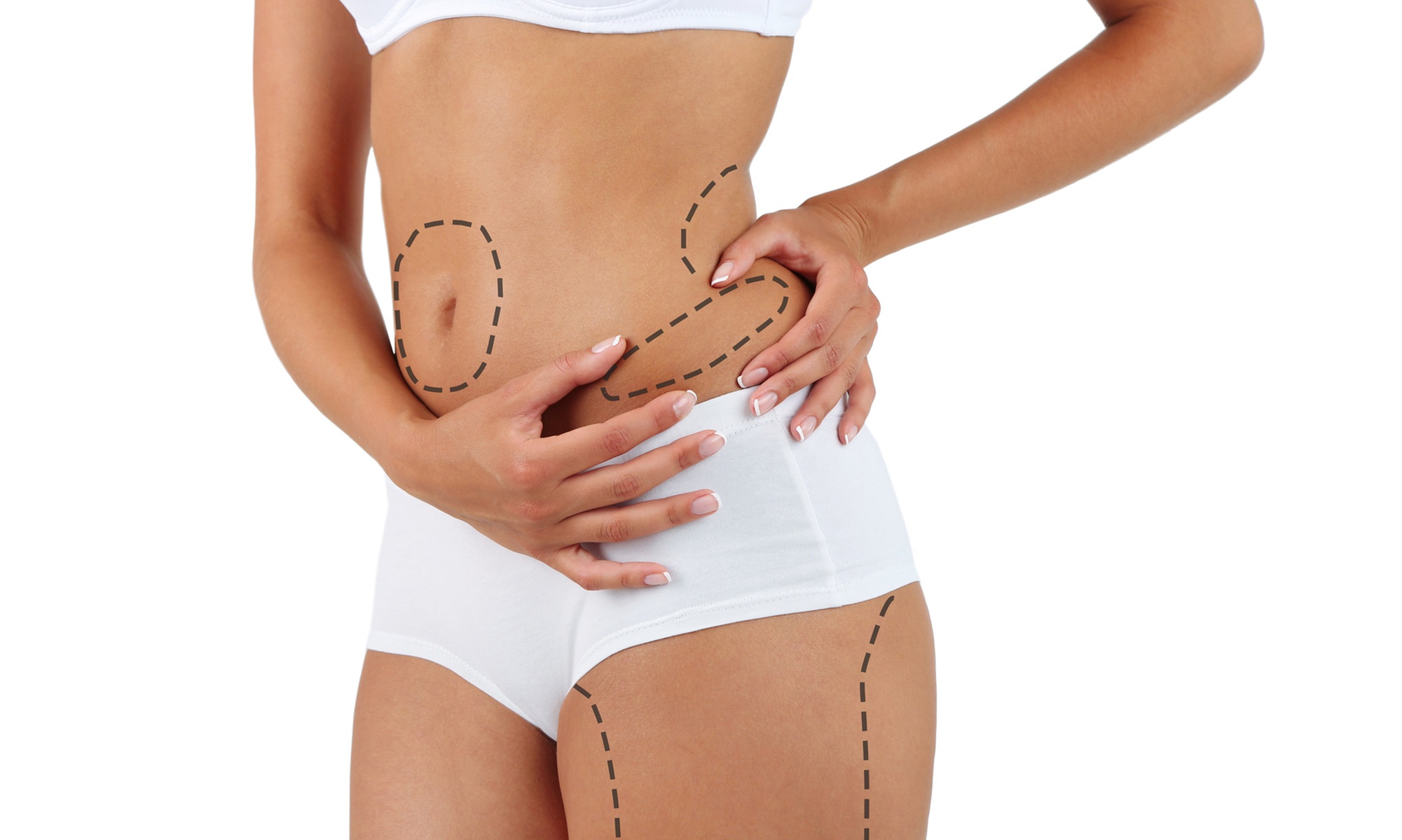 Up to 35% Off on Liposuction - Non-Invasive Laser (iLipo) at Luxuries By Lakay