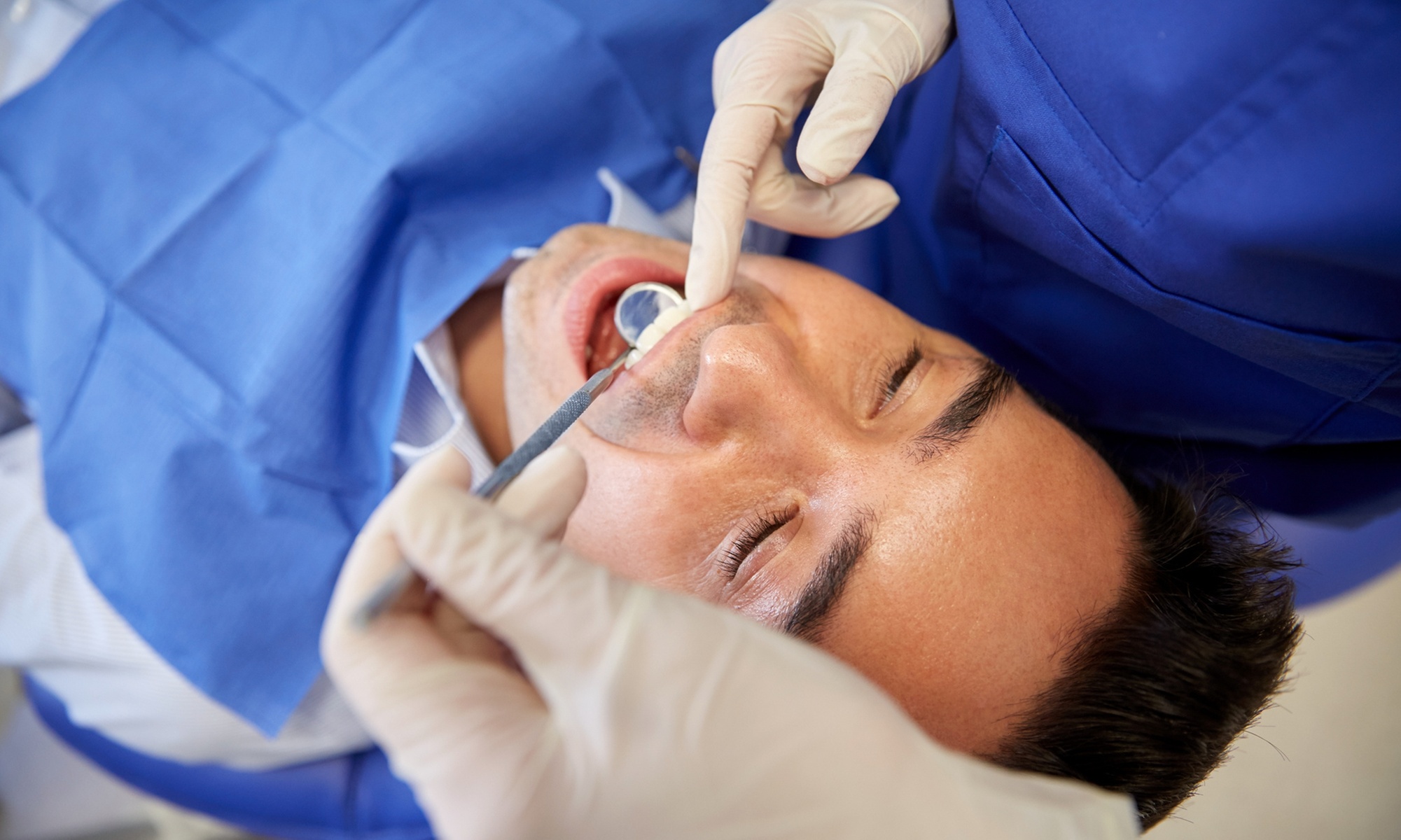 Get Radiant Smile with Dental Check Up, Clean Up ,OPG X-ray,& More