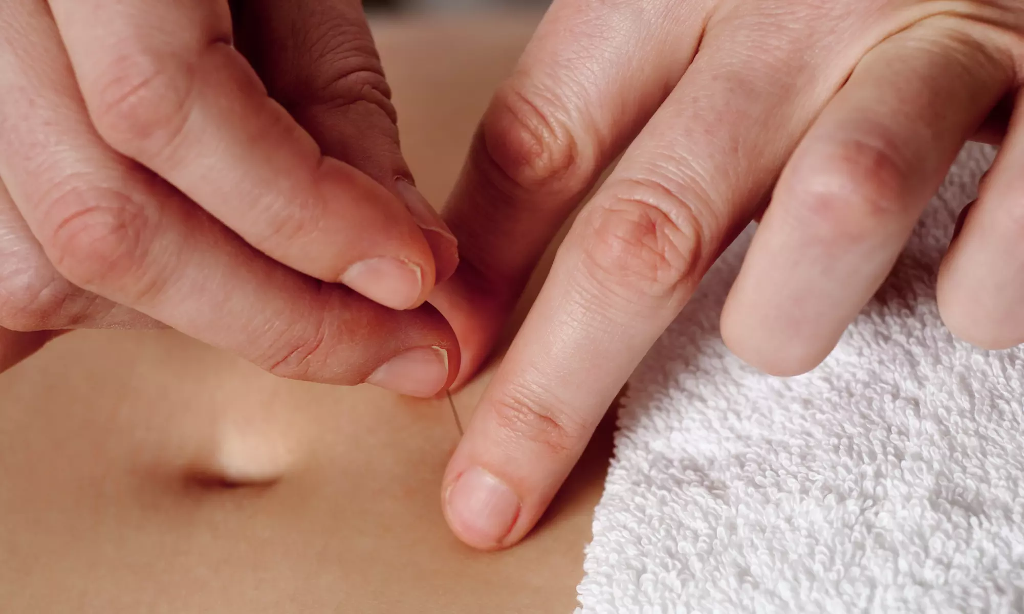 Revitalize with One or Two Acupuncture Sessions and Shockwaves