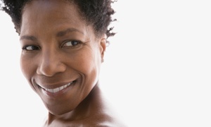 50% Off Non-Surgical Facelift at Nu Med Spa - Encino