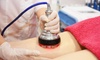 Tone with Cryolipolysis + EMS, Green Laser, Cellulite Reduction, Vibration Therapy or Plate & More(Up to 72%Off)