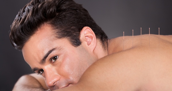 Experience acupuncture with consultation and multiple treatments
