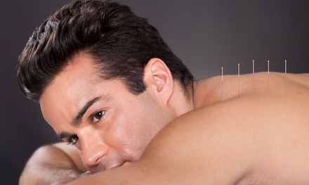Consultation and Three Acupuncture Treatments - Ideal Healthcare Solutions/Parkway Chiropractic Center